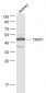 TRIP1 Polyclonal Antibody